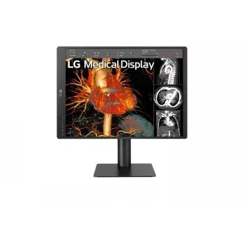LG 21,3 inch 3MP IPS Diagnosemonitor 21HQ513D-M